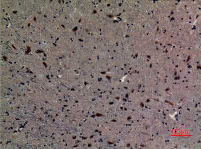 Anti-Ubiquitin Conjugating Enzyme E2 A/B Rabbit Polyclonal Antibody