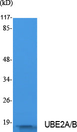 Anti-Ubiquitin Conjugating Enzyme E2 A/B Rabbit Polyclonal Antibody
