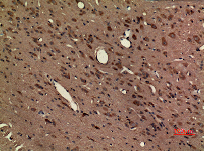Anti-Fractalkine Receptor Rabbit Polyclonal Antibody