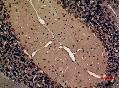 Anti-Fractalkine Receptor Rabbit Polyclonal Antibody