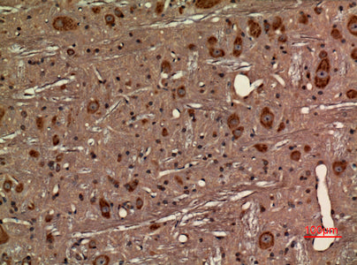 Anti-Fractalkine Receptor Rabbit Polyclonal Antibody