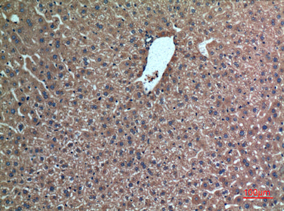 Anti-FGL1 Rabbit Polyclonal Antibody