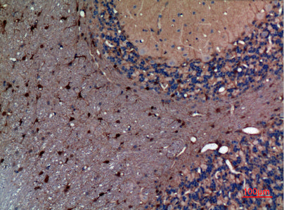 Anti-alpha 1 Fetoprotein Rabbit Polyclonal Antibody