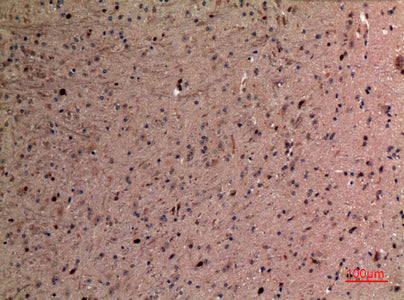Anti-alpha 1 Fetoprotein Rabbit Polyclonal Antibody