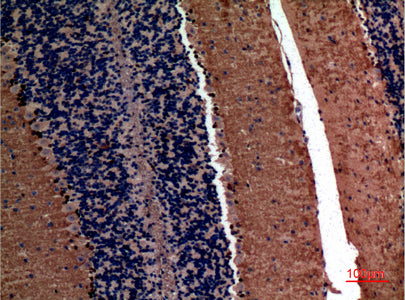 Anti-alpha 1 Fetoprotein Rabbit Polyclonal Antibody