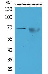 Anti-alpha 1 Fetoprotein Rabbit Polyclonal Antibody
