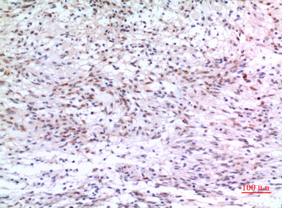 Anti-ZNF307 Rabbit Polyclonal Antibody