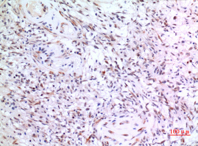 Anti-ZNF307 Rabbit Polyclonal Antibody