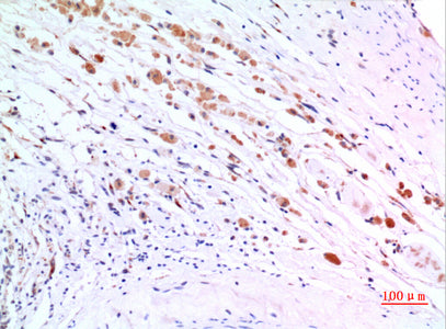 Anti-ZNF307 Rabbit Polyclonal Antibody
