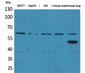 Anti-ZNF307 Rabbit Polyclonal Antibody