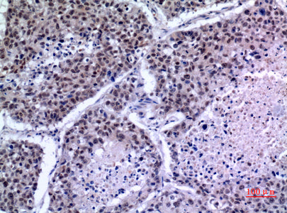 Anti-KLF13 Rabbit Polyclonal Antibody