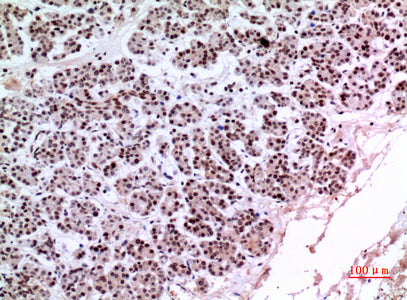 Anti-KLF13 Rabbit Polyclonal Antibody