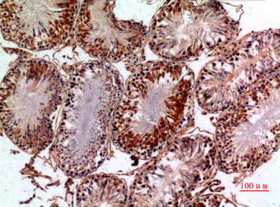 Anti-NTE Rabbit Polyclonal Antibody