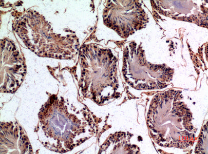 Anti-NTE Rabbit Polyclonal Antibody