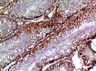 Anti-NTE Rabbit Polyclonal Antibody