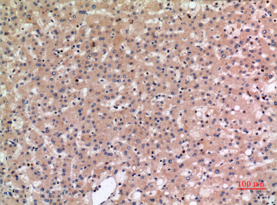 Anti-SLC10A1 Rabbit Polyclonal Antibody