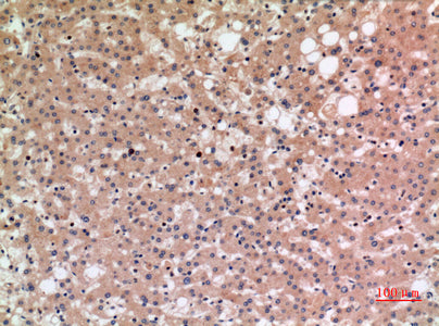 Anti-SLC10A1 Rabbit Polyclonal Antibody