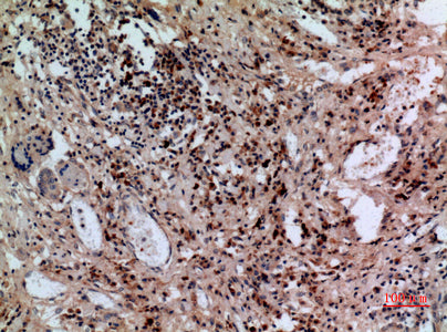 Anti-SLC10A1 Rabbit Polyclonal Antibody