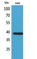 Anti-SLC10A1 Rabbit Polyclonal Antibody