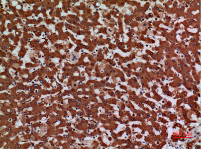 Anti-Laminin gamma 2 Rabbit Polyclonal Antibody