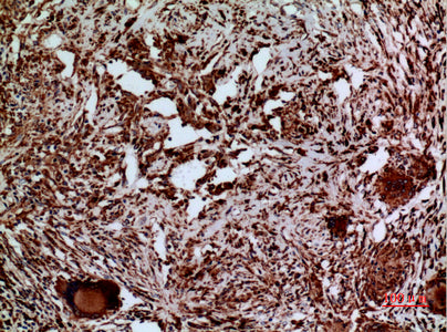 Anti-Laminin gamma 2 Rabbit Polyclonal Antibody