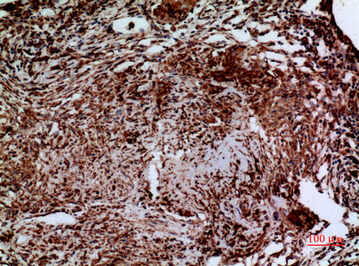 Anti-Laminin gamma 2 Rabbit Polyclonal Antibody