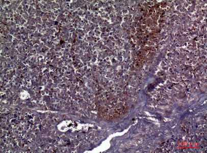 Anti-Collagen V alpha 2 Rabbit Polyclonal Antibody
