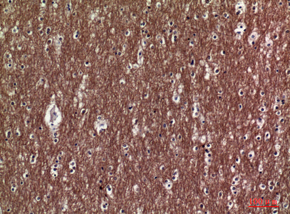 Anti-Collagen V alpha 2 Rabbit Polyclonal Antibody