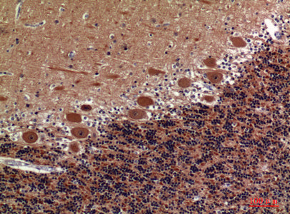 Anti-Collagen V alpha 2 Rabbit Polyclonal Antibody