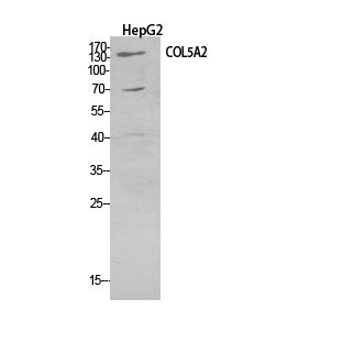 Anti-Collagen V alpha 2 Rabbit Polyclonal Antibody