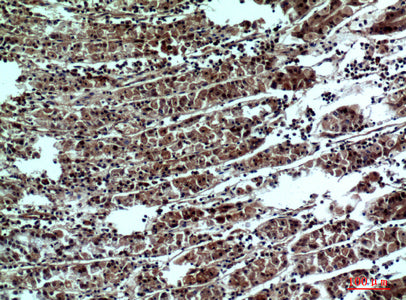 Anti-PPP1R15B Rabbit Polyclonal Antibody
