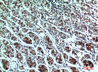 Anti-PPP1R15B Rabbit Polyclonal Antibody