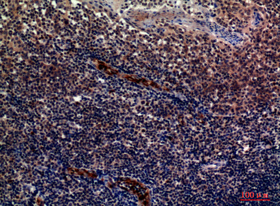 Anti-CD62P Rabbit Polyclonal Antibody