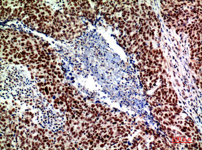 Anti-ASAH3L Rabbit Polyclonal Antibody
