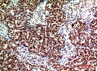 Anti-ASAH3L Rabbit Polyclonal Antibody
