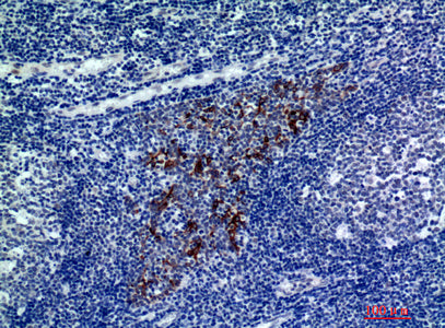 Anti-CMTM8 Rabbit Polyclonal Antibody