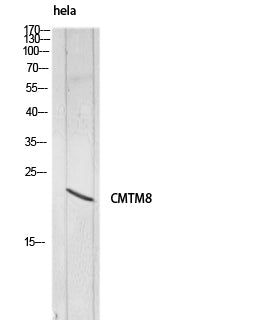 Anti-CMTM8 Rabbit Polyclonal Antibody