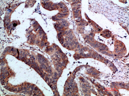 Anti-IL-37 Rabbit Polyclonal Antibody