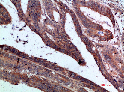 Anti-IL-37 Rabbit Polyclonal Antibody