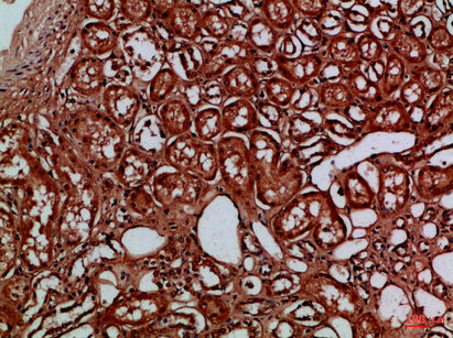 Anti-EYA1/4 Rabbit Polyclonal Antibody