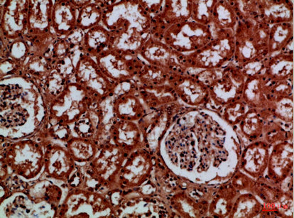 Anti-EYA1/4 Rabbit Polyclonal Antibody