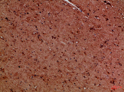 Anti-EYA1/4 Rabbit Polyclonal Antibody
