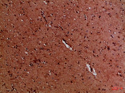 Anti-EYA1/4 Rabbit Polyclonal Antibody