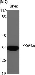 Anti-PP2A alpha Rabbit Polyclonal Antibody
