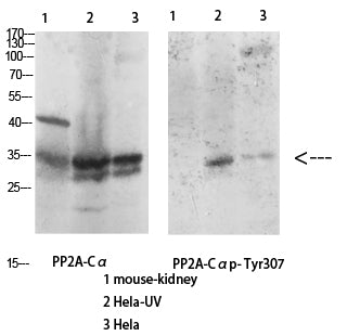 Anti-PP2A alpha Rabbit Polyclonal Antibody