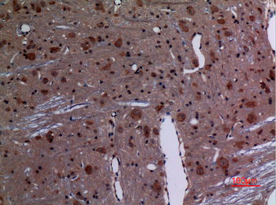 Anti-Rab26 Rabbit Polyclonal Antibody