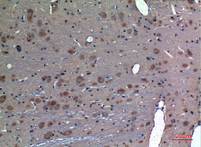 Anti-PREP Rabbit Polyclonal Antibody