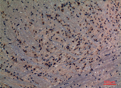 Anti-PREP Rabbit Polyclonal Antibody