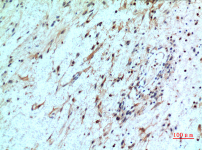 Anti-CXCR2 Rabbit Polyclonal Antibody