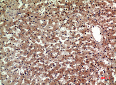 Anti-CRTH2 Rabbit Polyclonal Antibody